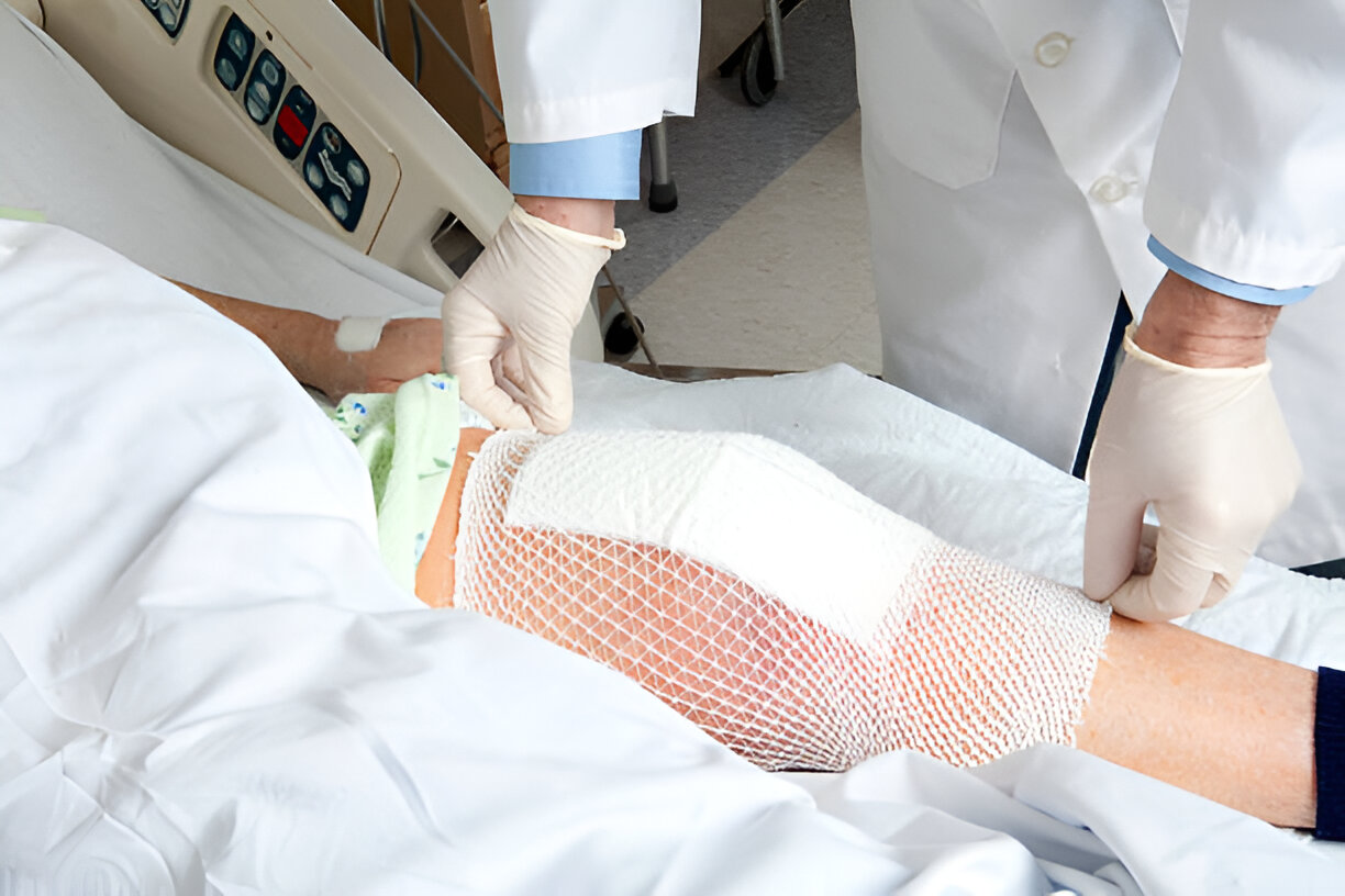 Total Knee Replacement Recovery Timeline - Dr Hesham