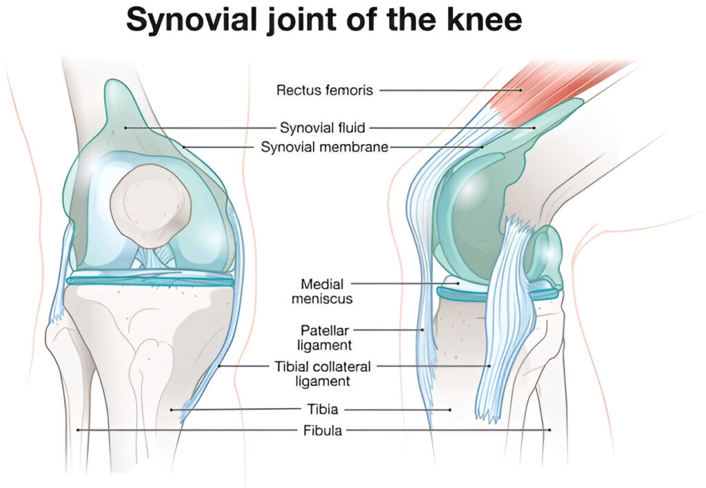Is it dangerous to have fluid on the knee