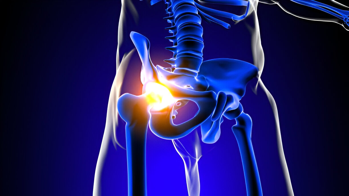 labral tear hip surgery