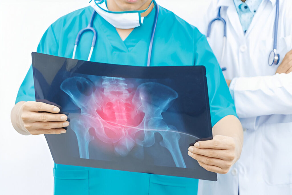 hip labral tear recovery
